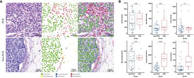Predictive model based on multiple immunofluorescence quantitative analysis for pathological complete response to neoadjuvant immunochemotherapy in lung squamous cell carcinoma